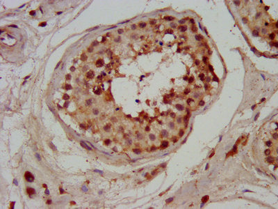 IHC image of CHMP1A Antibody diluted at 1:200 and staining in paraffin-embedded human testis tissue performed on a Leica BondTM system. After dewaxing and hydration, antigen retrieval was mediated by high pressure in a citrate buffer (pH 6.0). Section was blocked with 10% normal goat serum 30min at RT. Then primary antibody (1% BSA) was incubated at 4°C overnight. The primary is detected by a biotinylated secondary antibody and visualized using an HRP conjugated SP system.Rabbit anti-Human CHMP1A Polyclonal Antibody