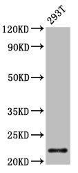 Western Blot  | Positive WB detected in: 293T whole cell lysate  | All lanes: CHMP1A antibody at 4.2µg/ml  | Secondary  | Goat polyclonal to rabbit IgG at 1/50000 dilution  | Predicted band size: 22, 8 kDa  | Observed band size: 22 kDaRabbit anti-Human CHMP1A Polyclonal Antibody