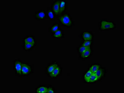 Immunofluorescent analysis of HepG2 cells using SLCO1B3 Antibody at dilution of 1:100 and Alexa Fluor 488-congugated AffiniPure Goat Anti-Rabbit IgG(H+L)Rabbit anti-Human SLCO1B3 Polyclonal Antibody