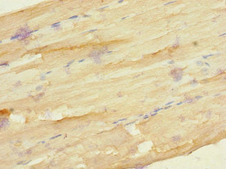 Immunohistochemistry of paraffin-embedded human skeletal muscle tissue using FZD3 Antibody at dilution of 1:100Rabbit anti-Human FZD3 Polyclonal Antibody