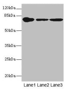 Western blot  | All lanes: FZD3 antibody at 1.94µg/ml  | Lane 1: THP-1 whole cell lysate  | Lane 2: Hela whole cell lysate  | Lane 3: HepG2 whole cell lysate  | Secondary  | Goat polyclonal to rabbit IgG at 1/10000 dilution  | Predicted band size: 77 kDa  | Observed band size: 77 kDaRabbit anti-Human FZD3 Polyclonal Antibody
