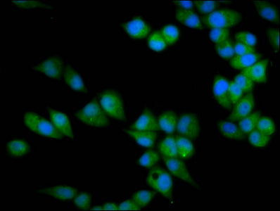 Immunofluorescence staining of Hela cells with PRSS16 Antibody at 1:133, counter-stained with DAPI. The cells were fixed in 4% formaldehyde, permeabilized using 0.2% Triton X-100 and blocked in 10% normal Goat Serum. The cells were then incubated with the antibody overnight at 4°C. The secondary antibody was Alexa Fluor 488-congugated AffiniPure Goat Anti-Rabbit IgG(H+L).Rabbit anti-Human PRSS16 Polyclonal Antibody