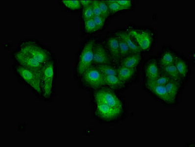 Immunofluorescent analysis of HepG2 cells using DDX4 Antibody at dilution of 1:100 and Alexa Fluor 488-congugated AffiniPure Goat Anti-Rabbit IgG(H+L)Rabbit anti-Human DDX4 Polyclonal Antibody
