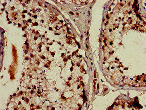 Immunohistochemistry of paraffin-embedded human testis tissue using DDX4 Antibody at dilution of 1:100Rabbit anti-Human DDX4 Polyclonal Antibody