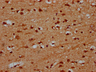 IHC image of PRDM11 Antibody diluted at 1:600 and staining in paraffin-embedded human brain tissue performed on a Leica BondTM system. After dewaxing and hydration, antigen retrieval was mediated by high pressure in a citrate buffer (pH 6.0). Section was blocked with 10% normal goat serum 30min at RT. Then primary antibody (1% BSA) was incubated at 4°C overnight. The primary is detected by a biotinylated secondary antibody and visualized using an HRP conjugated SP system.Rabbit anti-Human PRDM11 Polyclonal Antibody