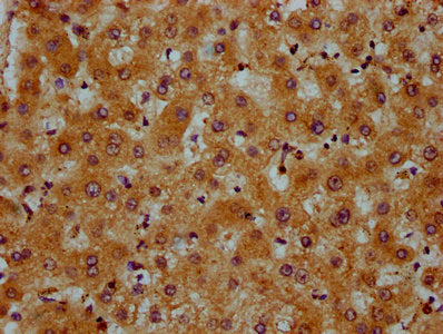 IHC image of PRDM11 Antibody diluted at 1:600 and staining in paraffin-embedded human liver tissue performed on a Leica BondTM system. After dewaxing and hydration, antigen retrieval was mediated by high pressure in a citrate buffer (pH 6.0). Section was blocked with 10% normal goat serum 30min at RT. Then primary antibody (1% BSA) was incubated at 4°C overnight. The primary is detected by a biotinylated secondary antibody and visualized using an HRP conjugated SP system.Rabbit anti-Human PRDM11 Polyclonal Antibody