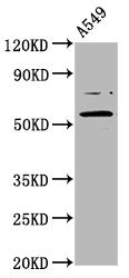 Western Blot  | Positive WB detected in: A549 whole cell lysate  | All lanes: PRDM11 antibody at 5.6µg/ml  | Secondary  | Goat polyclonal to rabbit IgG at 1/50000 dilution  | Predicted band size: 58, 54 kDa  | Observed band size: 58 kDaRabbit anti-Human PRDM11 Polyclonal Antibody