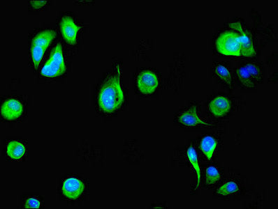 Immunofluorescent analysis of MCF-7 cells using DYRK4 Antibody at dilution of 1:100 and Alexa Fluor 488-congugated AffiniPure Goat Anti-Rabbit IgG(H+L)Rabbit anti-Human DYRK4 Polyclonal Antibody