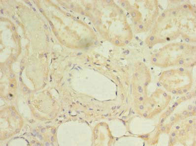 Immunohistochemistry of paraffin-embedded human kidney tissue using the antibody at dilution of 1:100Rabbit anti-Human DYRK4 Polyclonal Antibody