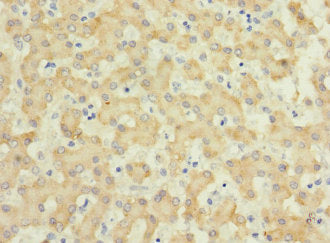 Immunohistochemistry of paraffin-embedded human liver tissue using IL17RB Antibody at dilution of 1:100Rabbit anti-Human IL17RB Polyclonal Antibody