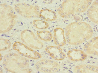 Immunohistochemistry of paraffin-embedded human kidney tissue using IL17RB Antibody at dilution of 1:100Rabbit anti-Human IL17RB Polyclonal Antibody