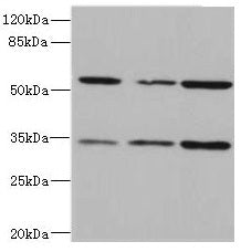 Western blot  | All lanes: IL17RB antibody at 2.16µg/ml  | Lane 1: 293T whole cell lysate  | Lane 2: Hela whole cell lysate  | Lane 3: HepG2 whole cell lysate  | Secondary  | Goat polyclonal to rabbit IgG at 1/10000 dilution  | Predicted band size: 56, 32 kDa  | Observed band size: 56, 32 kDa