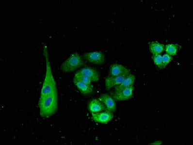 Immunofluorescent analysis of HepG2 cells using SNX15 Antibody at dilution of 1:100 and Alexa Fluor 488-congugated AffiniPure Goat Anti-Rabbit IgG(H+L)Rabbit anti-Human SNX15 Polyclonal Antibody