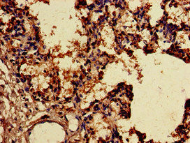 Immunohistochemistry of paraffin-embedded human lung tissue using SNX15 Antibody at dilution of 1:100Rabbit anti-Human SNX15 Polyclonal Antibody