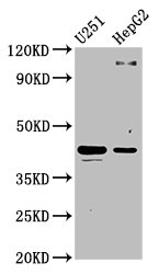 Western Blot  | Positive WB detected in: U251 whole cell lysate, HepG2 whole cell lysate  | All lanes: C1GALT1 antibody at 4.4µg/ml  | Secondary  | Goat polyclonal to rabbit IgG at 1/50000 dilution  | Predicted band size: 43, 36 kDa  | Observed band size: 43 kDa