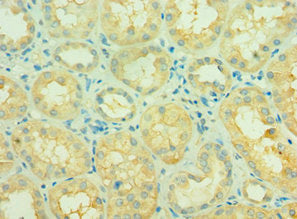 Immunohistochemistry of paraffin-embedded human kidney tissue using SIRT3 Antibody at dilution of 1:100Rabbit anti-Human SIRT3 Polyclonal Antibody