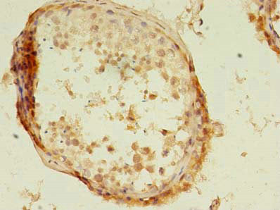 Immunohistochemistry of paraffin-embedded human testis tissue using KBTBD4 Antibody at dilution of 1:100