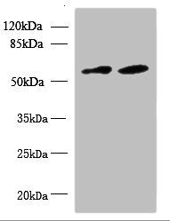 Western blot | All lanes: KBTBD4 antibody at 10μg/ml | Lane 1: U87 whole cell lysate | Lane 2: NIH/3T3 whole cell lysate | Secondary | Goat polyclonal to rabbit IgG at 1/10000 dilution | Predicted band size: 59, 60 kDa | Observed band size: 59 kDa