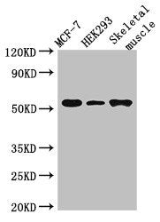 Western Blot  | Positive WB detected in: MCF-7 whole cell lysate, HEK293 whole cell lysate, Mouse skeletal muscle tissue  | All lanes: RMND1 antibody at 3µg/ml  | Secondary  | Goat polyclonal to rabbit IgG at 1/50000 dilution  | Predicted band size: 52, 28, 24 kDa  | Observed band size: 52 kDaRabbit anti-Human RMND1 Polyclonal Antibody