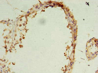 Immunohistochemistry of paraffin-embedded human testis tissue using OCIAD1 Antibody at dilution of 1:100Rabbit anti-Human OCIAD1 Polyclonal Antibody