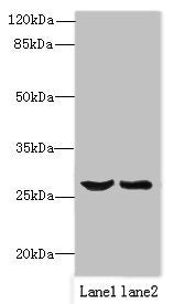 Western blot | All lanes: OCIAD1 antibody at 1μg/ml | Lane 1: Mouse liver tissue | Lane 2: Mouse kidney tissue | Secondary | Goat polyclonal to rabbit IgG at 1/10000 dilution | Predicted band size: 28, 21, 22 kDa | Observed band size: 28 kDaRabbit anti-Human OCIAD1 Polyclonal Antibody