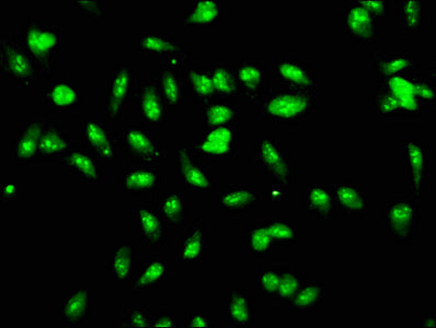 Immunofluorescence staining of Hela cells with LYAR Antibody at 1:166, counter-stained with DAPI. The cells were fixed in 4% formaldehyde, permeabilized using 0.2% Triton X-100 and blocked in 10% normal Goat Serum. The cells were then incubated with the antibody overnight at 4°C. The secondary antibody was Alexa Fluor 488-congugated AffiniPure Goat Anti-Rabbit IgG(H+L).