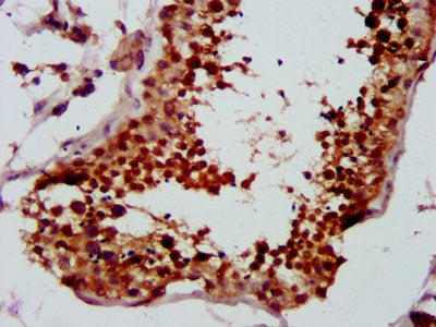 IHC image of LYAR Antibody diluted at 1:500 and staining in paraffin-embedded human testis tissue performed on a Leica BondTM system. After dewaxing and hydration, antigen retrieval was mediated by high pressure in a citrate buffer (pH 6.0). Section was blocked with 10% normal goat serum 30min at RT. Then primary antibody (1% BSA) was incubated at 4°C overnight. The primary is detected by a biotinylated secondary antibody and visualized using an HRP conjugated SP system.