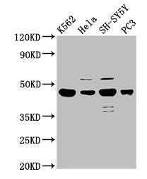 Western Blot | Positive WB detected in: K562 whole cell lysate, Hela whole cell lysate, SH-SY5Y whole cell lysate, PC-3 whole cell lysate | All lanes: LYAR antibody at 2.5μg/ml | Secondary | Goat polyclonal to rabbit IgG at 1/50000 dilution | Predicted band size: 44 kDa | Observed band size: 44 kDa
