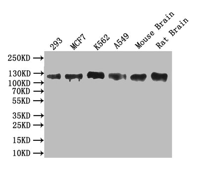 Western Blot Positive WB detected in: 293 whole cell lysate, MCF7 whole cell lysate, K562 whole cell lysate, A549 whole cell lysate, Mouse Brain tissue lysate, Mouse Brain tissue lysate All lanes: MCM9 antibody at 1:1000 Secondary Goat polyclonal to rabbit IgG at 1/50000 dilution Predicted band size: 127/85/72/48 kDa Observed band size: 127 kDa