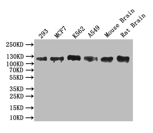 Western Blot Positive WB detected in: 293 whole cell lysate, MCF7 whole cell lysate, K562 whole cell lysate, A549 whole cell lysate, Mouse Brain tissue lysate, Mouse Brain tissue lysate All lanes: MCM9 antibody at 1:1000 Secondary Goat polyclonal to rabbit IgG at 1/50000 dilution Predicted band size: 127/85/72/48 kDa Observed band size: 127 kDa