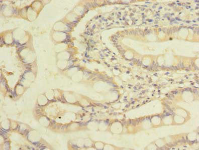 Immunohistochemistry of paraffin-embedded human small intestine tissue using ZDHHC3 Antibody at dilution of 1:100Rabbit anti-Human ZDHHC3 Polyclonal Antibody