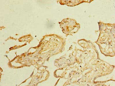 Immunohistochemistry of paraffin-embedded human placenta tissue using ZDHHC3 Antibody at dilution of 1:100Rabbit anti-Human ZDHHC3 Polyclonal Antibody