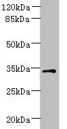Western blot | All lanes: ZDHHC3 antibody at 1.5μg/ml + Mouse brain tissue | Secondary | Goat polyclonal to rabbit IgG at 1/10000 dilution | Predicted band size: 35, 38 kDa | Observed band size: 35 kDaRabbit anti-Human ZDHHC3 Polyclonal Antibody