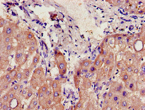 Immunohistochemistry of paraffin-embedded human liver tissue using CYP39A1 Antibody at dilution of 1:100Rabbit anti-Human CYP39A1 Polyclonal Antibody