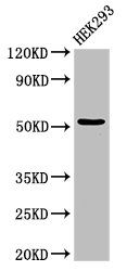 Western Blot  | Positive WB detected in: HEK293 whole cell lysate  | All lanes: CYP39A1 antibody at 3µg/ml  | Secondary  | Goat polyclonal to rabbit IgG at 1/50000 dilution  | Predicted band size: 55 kDa  | Observed band size: 55 kDaRabbit anti-Human CYP39A1 Polyclonal Antibody