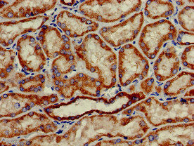 Immunohistochemistry of paraffin-embedded human kidney tissue using HAO2 Antibody at dilution of 1:100Rabbit anti-Human HAO2 Polyclonal Antibody