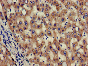 Immunohistochemistry of paraffin-embedded human liver tissue using HAO2 Antibody at dilution of 1:100Rabbit anti-Human HAO2 Polyclonal Antibody