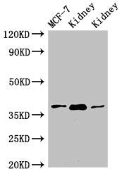 Western Blot | Positive WB detected in: MCF-7 whole cell lysate, Rat kidney tissue, Mouse kidney tissue | All lanes: HAO2 antibody at 3μg/ml | Secondary | Goat polyclonal to rabbit IgG at 1/50000 dilution | Predicted band size: 39, 41 kDa | Observed band size: 39 kDaRabbit anti-Human HAO2 Polyclonal Antibody