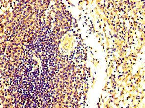 IHC image of FASTKD2 Antibody diluted at 1:300 and staining in paraffin-embedded human spleen tissue performed on a Leica BondTM system. After dewaxing and hydration, antigen retrieval was mediated by high pressure in a citrate buffer (pH 6.0). Section was blocked with 10% normal goat serum 30min at RT. Then primary antibody (1% BSA) was incubated at 4°C overnight. The primary is detected by a biotinylated secondary antibody and visualized using an HRP conjugated SP system.Rabbit anti-Human FASTKD2 Polyclonal Antibody