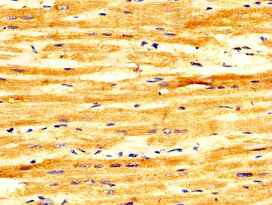 IHC image of FASTKD2 Antibody diluted at 1:300 and staining in paraffin-embedded human heart tissue performed on a Leica BondTM system. After dewaxing and hydration, antigen retrieval was mediated by high pressure in a citrate buffer (pH 6.0). Section was blocked with 10% normal goat serum 30min at RT. Then primary antibody (1% BSA) was incubated at 4°C overnight. The primary is detected by a biotinylated secondary antibody and visualized using an HRP conjugated SP system.Rabbit anti-Human FASTKD2 Polyclonal Antibody