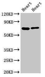 Western Blot | Positive WB detected in: Rat heart tisseu, Mouse heart tissue | All lanes: FASTKD2 antibody at 8μg/ml | Secondary | Goat polyclonal to rabbit IgG at 1/50000 dilution | Predicted band size: 82, 75 kDa | Observed band size: 75 kDaRabbit anti-Human FASTKD2 Polyclonal Antibody