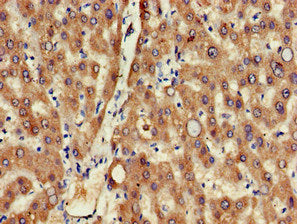Immunohistochemistry of paraffin-embedded human liver tissue using the antibody at dilution of 1:100Rabbit anti-Human MSRB1 Polyclonal Antibody