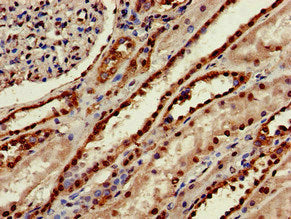 Immunohistochemistry of paraffin-embedded human kidney tissue using MSRB1 Antibody at dilution of 1:100Rabbit anti-Human MSRB1 Polyclonal Antibody