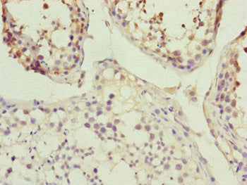 Immunohistochemistry of paraffin-embedded human testis tissue using KANSL3 Antibody at dilution of 1:100
