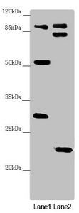 Western blot | All lanes: KANSL3 antibody at 1.68 μg/ml | Lane 1: U251 whole cell lysate | Lane 2: Mouse small intestine tissue | Secondary | Goat polyclonal to rabbit IgG at 1/10000 dilution | Predicted band size: 96, 84, 94, 81, 17, 59 kDa | Observed band size: 96, 83, 53, 31, 23 kDa