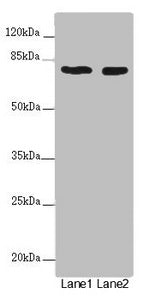 Western blot  | All lanes: UVRAG antibody at 2µg/ml  | Lane 1: SH-SY5Y whole cell lysate  | Lane 2: 293T whole cell lysate  | Secondary  | Goat polyclonal to rabbit IgG at 1/10000 dilution  | Predicted band size: 79, 36 kDa  | Observed band size: 79 kDaRabbit anti-Human UVRAG Polyclonal Antibody