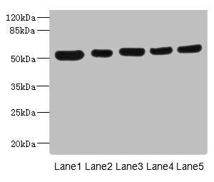 Western blot  | All lanes: ATXN10 antibody at 4.79µg/ml  | Lane 1: A431 whole cell lysate  | Lane 2: LO2 whole cell lysate  | Lane 3: HepG2 whole cell lysate  | Lane 4: 293T whole cell lysate  | Lane 5: Hela whole cell lysate  | Secondary  | Goat polyclonal to rabbit IgG at 1/10000 dilution  | Predicted band size: 54, 47 kDa  | Observed band size: 54 kDa