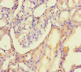 Immunohistochemistry of paraffin-embedded human kidney tissue using DNMT3B Antibody at dilution of 1:100Rabbit anti-Human DNMT3B Polyclonal Antibody