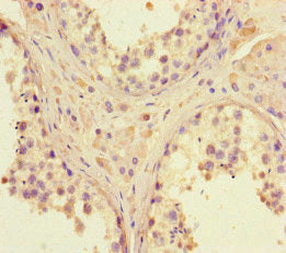 Immunohistochemistry of paraffin-embedded human testis tissue using DNMT3B Antibody at dilution of 1:100Rabbit anti-Human DNMT3B Polyclonal Antibody