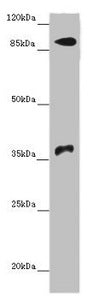 Western blot  | All lanes: DNMT3B antibody at 14µg/ml + Hela whole cell lysate  | Secondary  | Goat polyclonal to rabbit IgG at 1/10000 dilution  | Predicted band size: 96, 94, 87, 81, 89, 95, 78, 82 kDa  | Observed band size: 96, 37 kDaRabbit anti-Human DNMT3B Polyclonal Antibody
